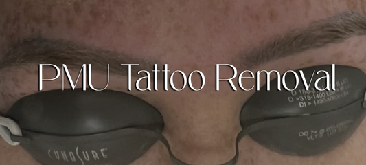 Permanent Makeup (PMU)(Ombre Brow) Tattoo Removal