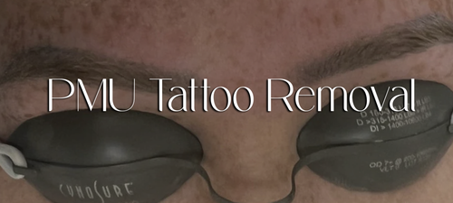 Permanent Makeup (PMU)(Ombre Brow) Tattoo Removal